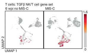 Nature新研究確定了兒童COVID感染后炎癥性休克的原因 Nature新研究確定了兒童COVID感染后炎癥性休克的原因