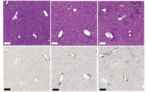 CD4+ T細胞通過激活庫普弗細胞分泌IL-27逆轉HBV誘導的CD8+ T細胞功能障礙的機制研究 CD4+ T細胞通過激活庫普弗細胞分泌IL-27逆轉HBV誘導的CD8+ T細胞功能障礙的機制研究