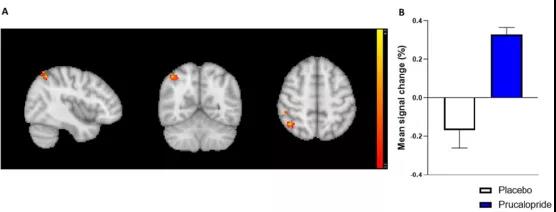?牛津科學家發現：通便也能通記憶，這種藥物或可促認知作用