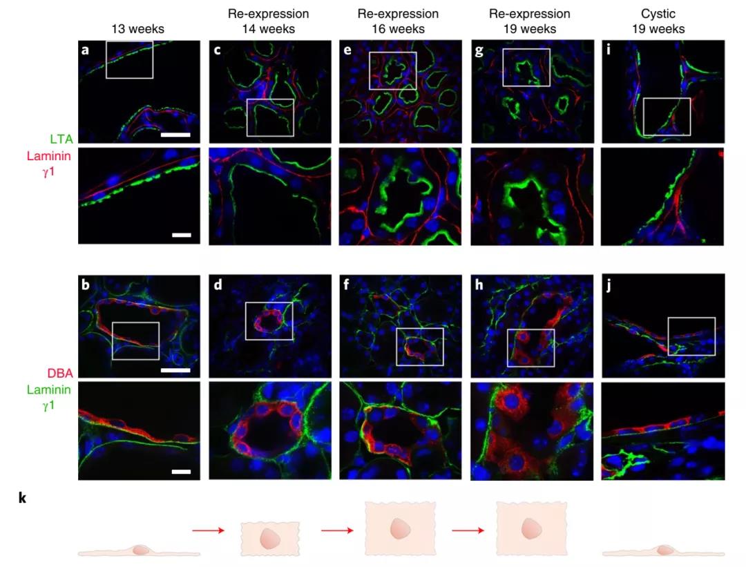 無需腎移植!Nature子刊:科學家通過逆轉小鼠多囊腎病揭示腎臟的可塑性 無需腎移植!Nature子刊:科學家通過逆轉小鼠多囊腎病揭示腎臟的可塑性