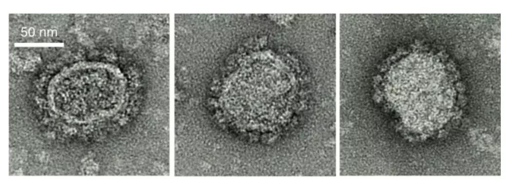 Nature子刊：防“艾”疫苗有望 恒河猴感染風險降低79%