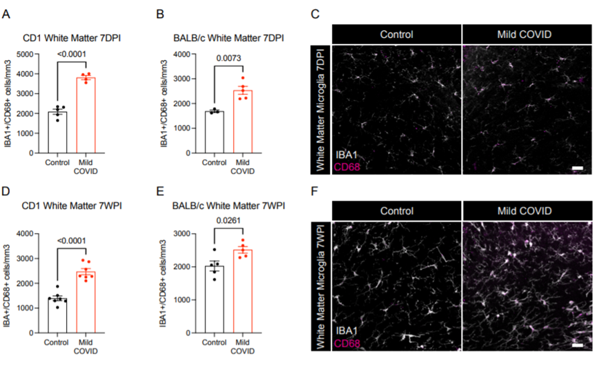 新冠竟能“傷腦”?耶魯科學家找到SARS-CoV-2損害神經(jīng)系統(tǒng)新證據(jù) 新冠竟能“傷腦”?耶魯科學家找到SARS-CoV-2損害神經(jīng)系統(tǒng)新證據(jù)