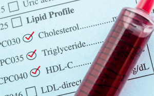 高、低密度脂蛋白膽固醇(HDL /LDL-C)檢測解決方案 高、低密度脂蛋白膽固醇(HDL /LDL-C)檢測解決方案