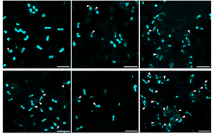 Science Advances:葉綠體的作用不僅僅是光合作用!免疫防御中隱藏的玩家 Science Advances:葉綠體的作用不僅僅是光合作用!免疫防御中隱藏的玩家