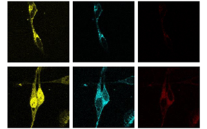 PNAS：脂肪酸調節脂質生物合成的新途徑