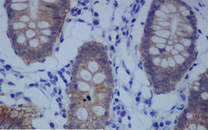 《PNAS》一種不為人知的蛋白質,它能保持人體細胞的健康 《PNAS》一種不為人知的蛋白質,它能保持人體細胞的健康