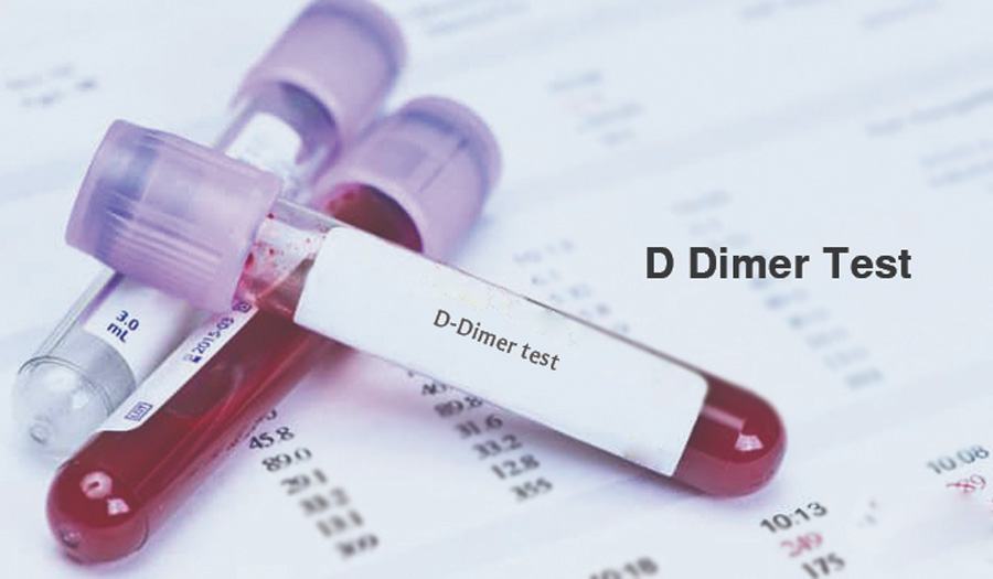 D-二聚體（D-Dimer）-磁微?；瘜W(xué)法學(xué)發(fā)光（AP/AE） /熒光免疫層析解決方案