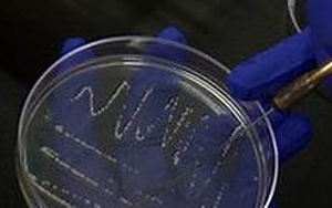 《Nature》科學家揭開了一種致命霍亂病菌背后的神秘面紗 《Nature》科學家揭開了一種致命霍亂病菌背后的神秘面紗