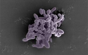 Science Immunology:一種腸道細菌可以增強免疫反應,增強癌癥免疫治療 Science Immunology:一種腸道細菌可以增強免疫反應,增強癌癥免疫治療